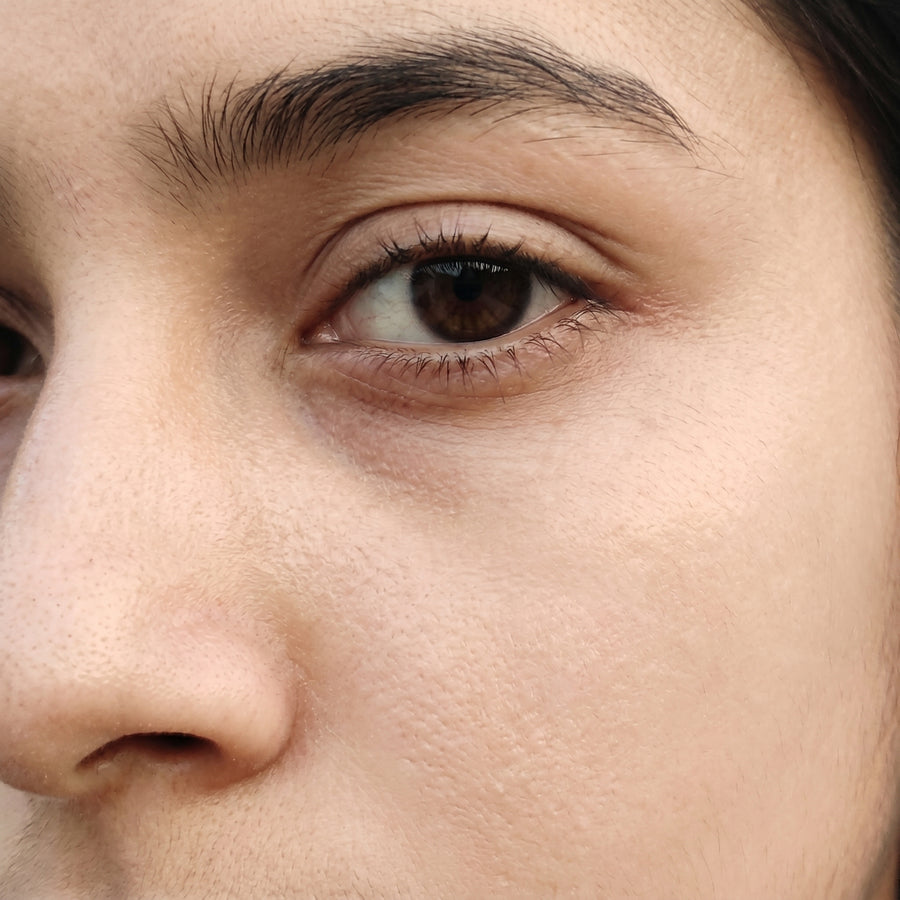 Before - Dull & Dry Skin